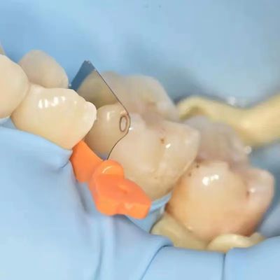Matrix Holder Dental Tofflemire Band Clamp Ring Resin Holder Clip Ring A4